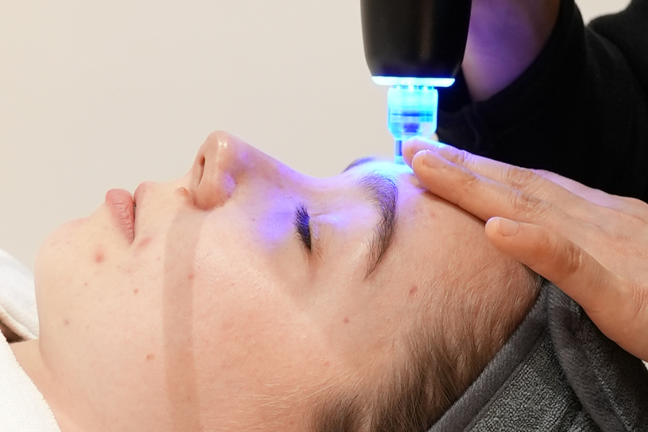 Acne Treatment Course