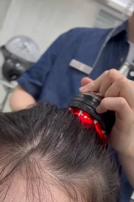 15-Step Scalp Treatment 2