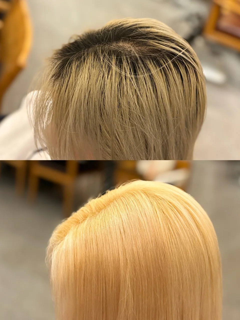 Root Bleaching *up to 2cm* 1