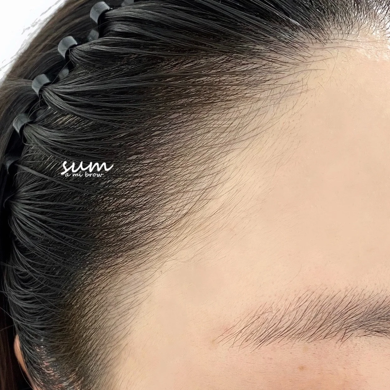 Hairline Enhancement 1