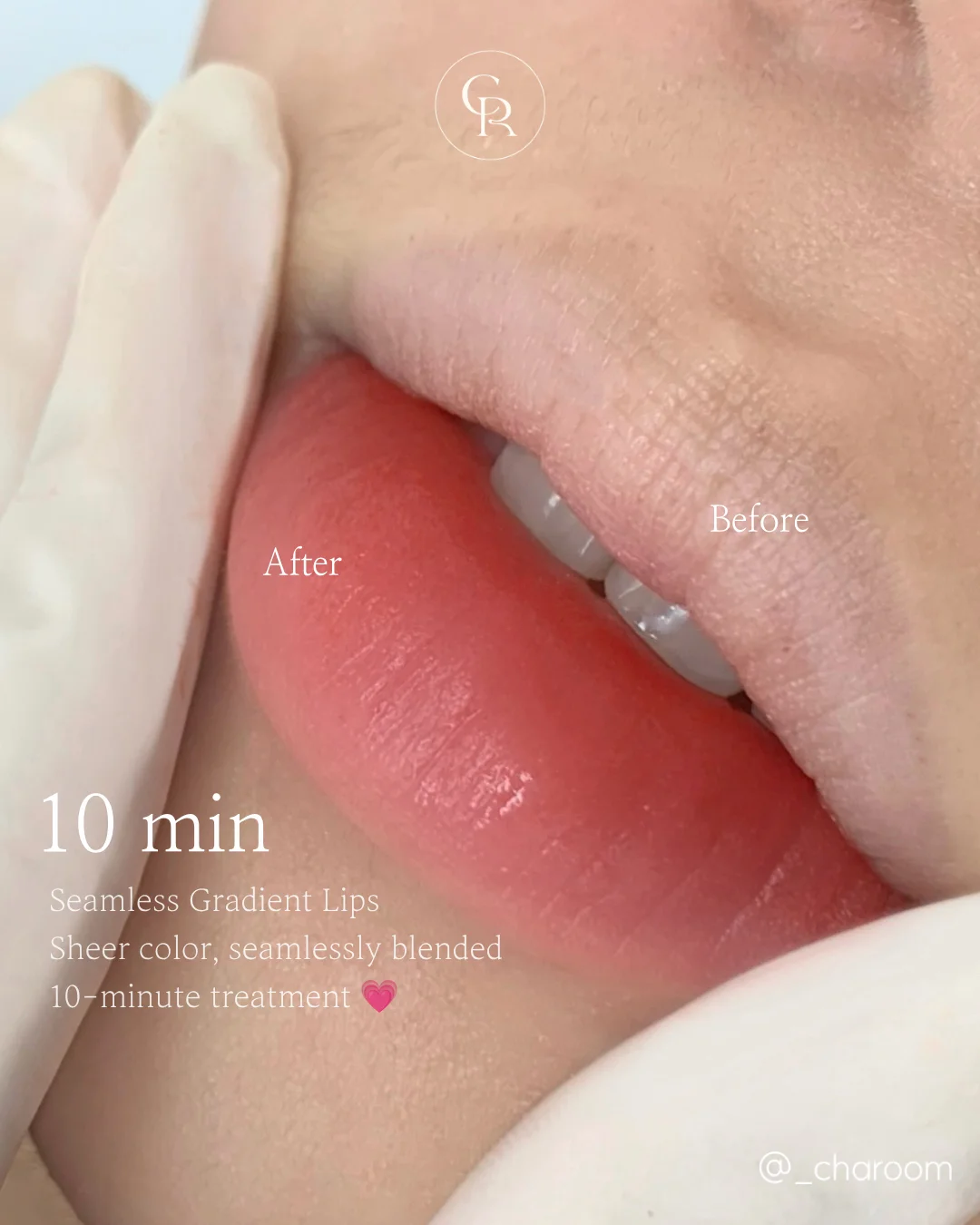 Jelly Lip 1