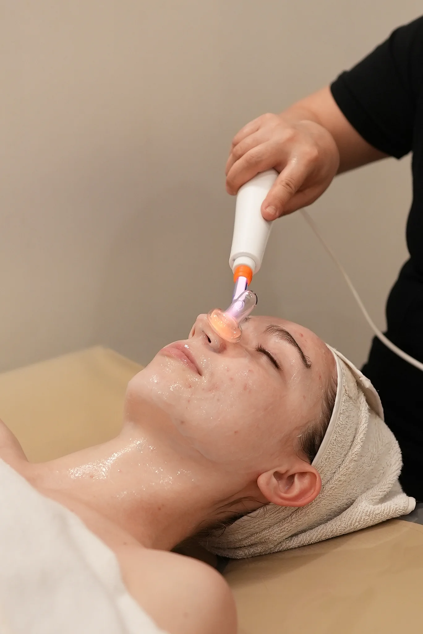 Dual Plasma Acne Treatment (1 Body Part or Face Care) 2