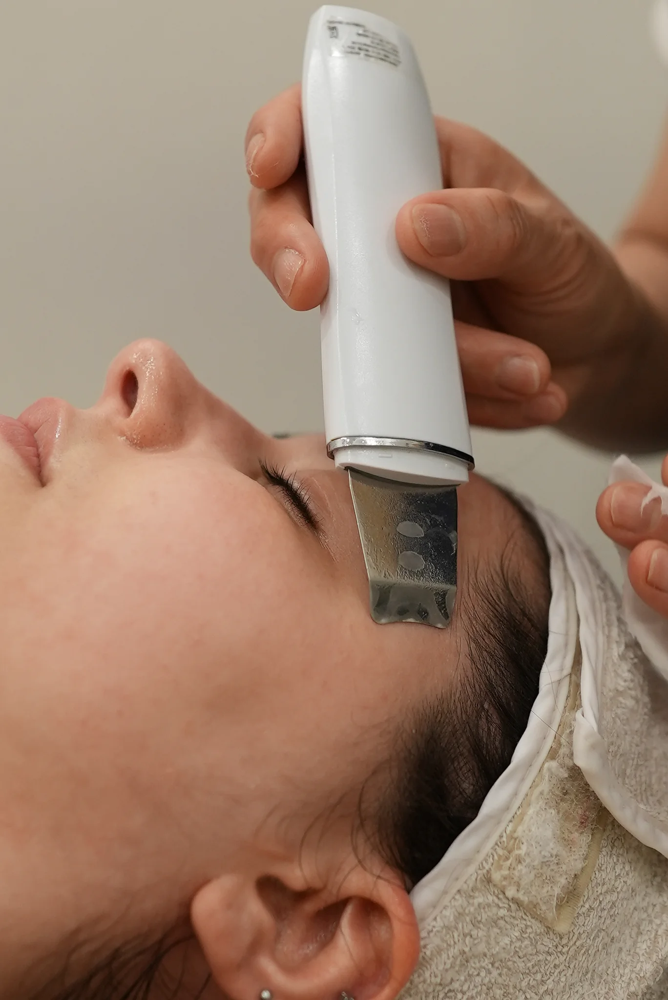 Acne Medical Care with Décolleté Massage 1