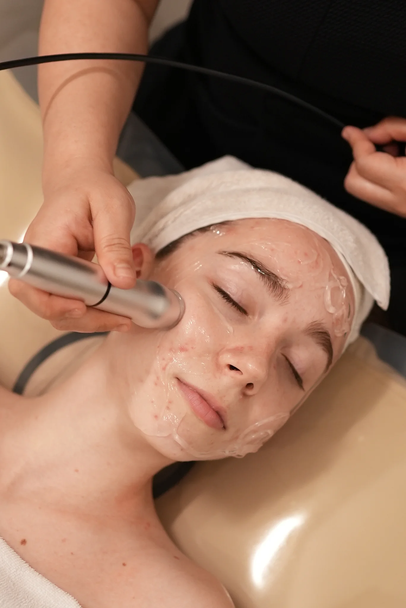 Signature Facial Contouring + HIFU 1