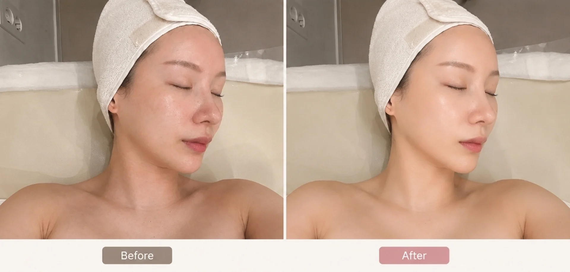 ONDA Wave Lifting (Face) 4