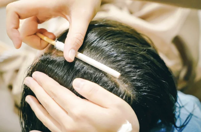 Power Scalp Scaling 1