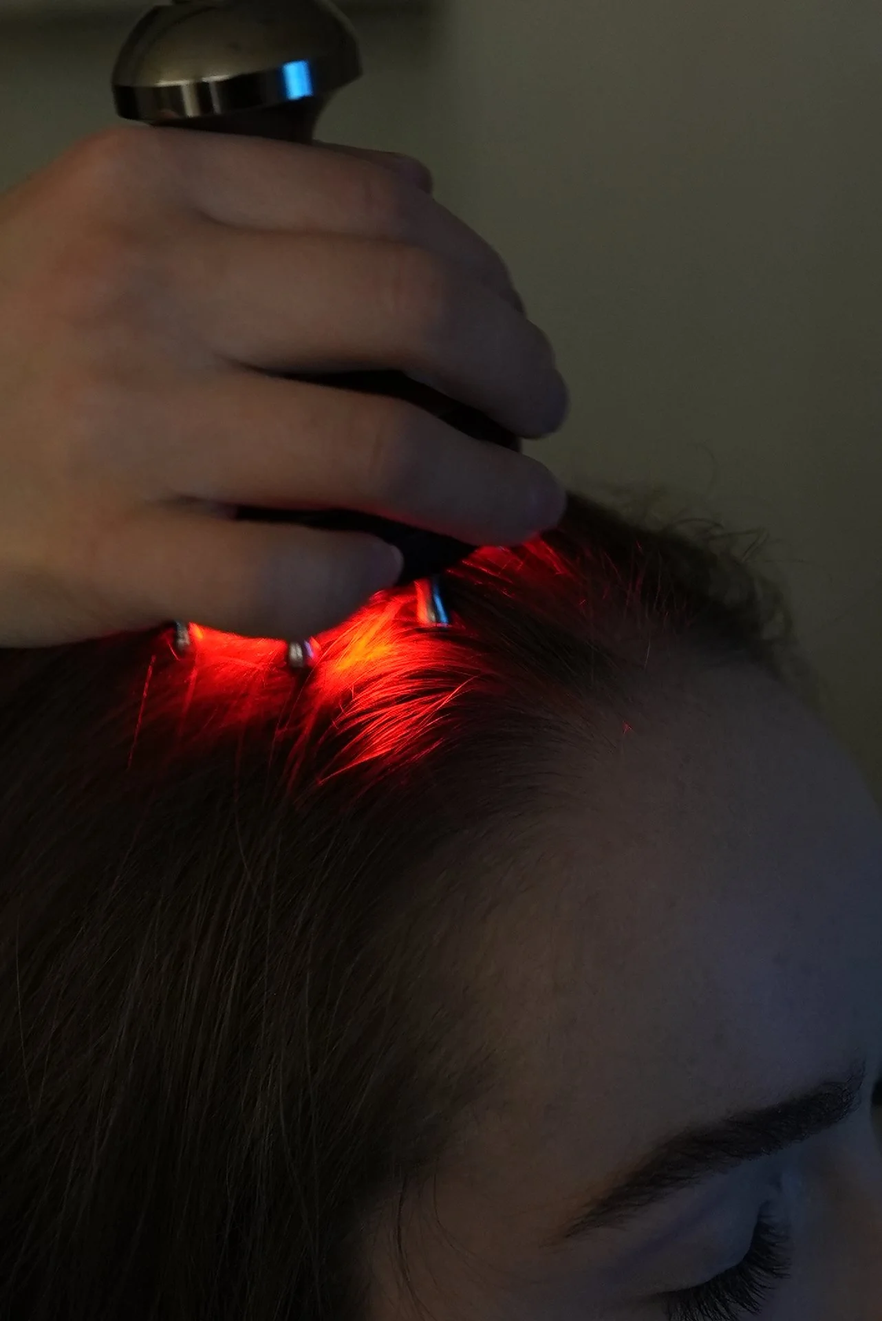 15-Step Stem Cell Scalp Treatment 3