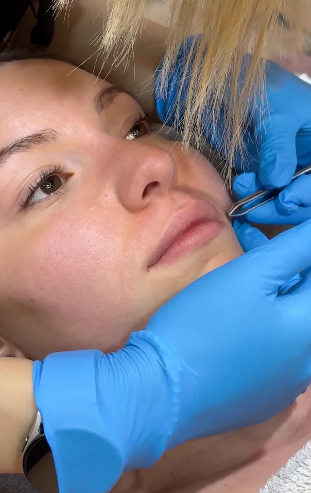 Upper Lip Waxing Women 1
